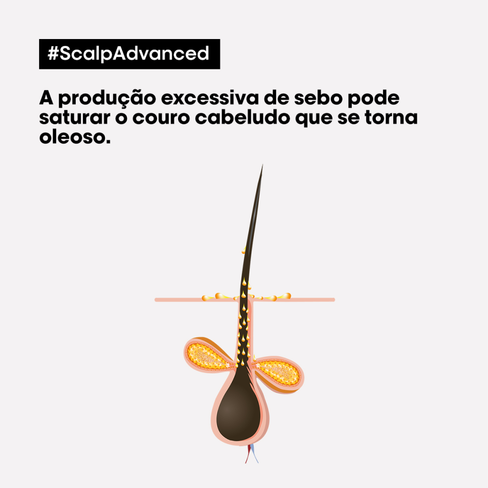 L'oreal Scalp Advanced Oily Shampoo Serie Expert 1500ml