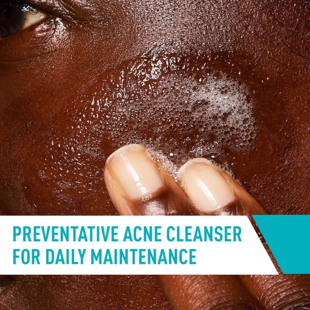 CeraVe Acne Control Cleanser 355ml