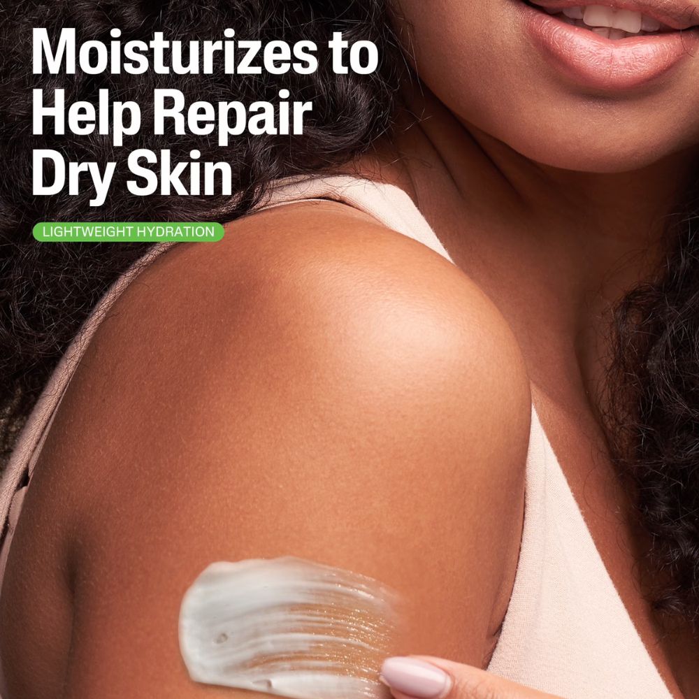 Cetaphil Moisturizing Lotion Normal To Dry Skin 237ml
