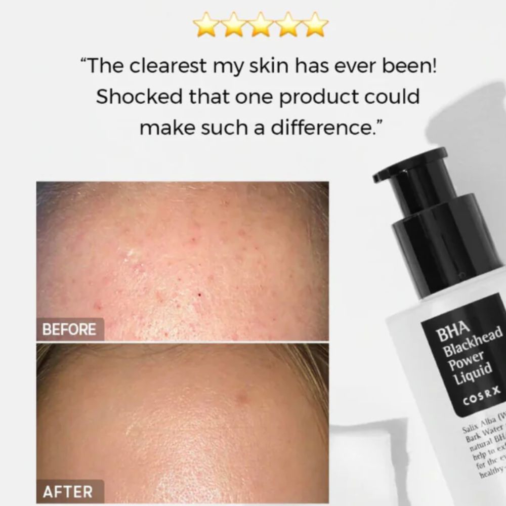 COSRX BHA Blackhead Power Liquid 100ml